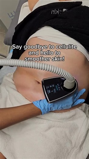 Olivo Med Spa | Enhance your body contouring results 💥 BTL Cellutone improves lymphatic drainage and skin firmness—perfect to pair with Emsculpt or Exion... | Instagram