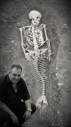 mermaid syndrome ( rare human mutations iceberg chart explained)