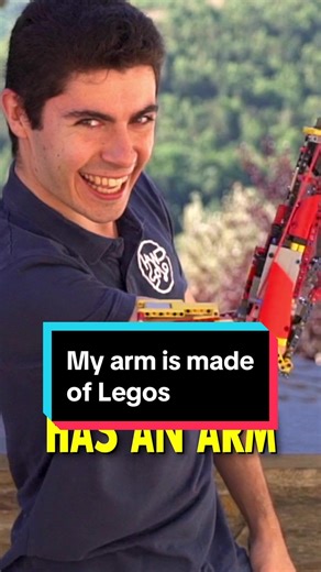 Inspiring Story: Man Builds Prosthetic Lego Arm | Amazing Humans