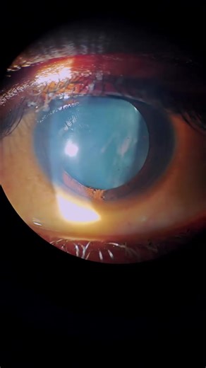 Understanding Ophthalmology Diagnoses: Insights & Tips