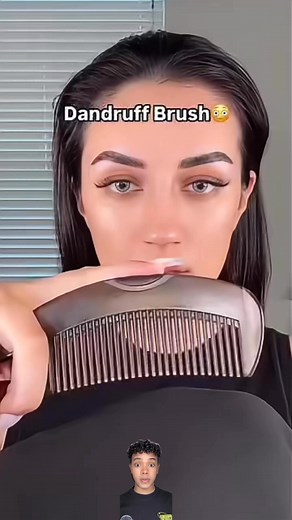 60K views · 148 reactions | Testing the comb that promises to remove all dandruff! #comb #Dandruff #dandruffremoval | Noah | Facebook