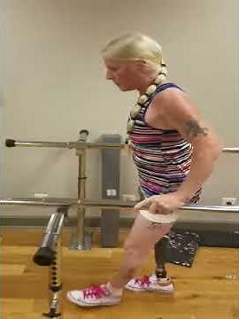 Hip disarticulation amputee walking for the first time.