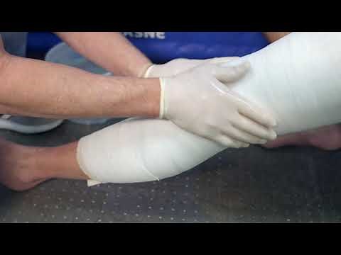 KO Casting Instructions