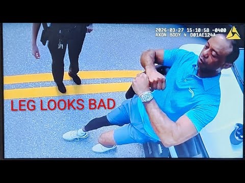 TIGER WOODS LEG LOOKS HORRIBLE