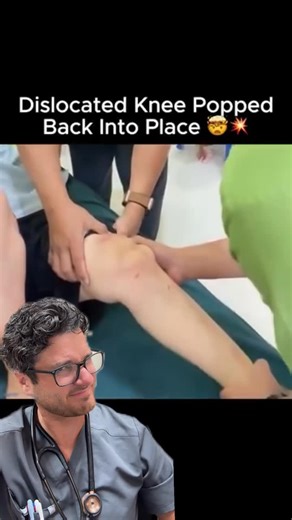 Dr. Chad on Instagram: "Very satisfying reductions ✨.... Patellar dislocations happen when the kneecap (patella) slips out of its groove on the femur — usually to the outer side of the knee. It’s often caused by a sudden twist, awkward landing, or direct blow during sports or activity. After a dislocation, the knee may appear deformed, swollen, and extremely painful until the patella is reduced — meaning it’s gently guided back into place, either spontaneously or by a medical provider. Even afte