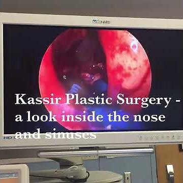 Look inside the nose and sinuses