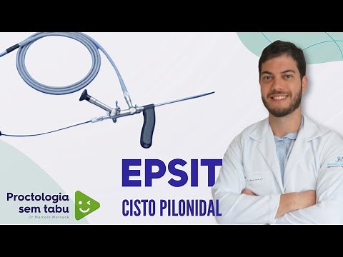 Video-assisted pilonidal cyst surgery. What's it like?