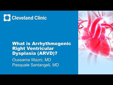 What is Arrhythmogenic Right Ventricular Dysplasia (ARVD)?
