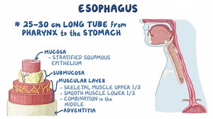 Video: Esophageal disorders: Clinical - Video Explanation! | Osmosis | Osmosis