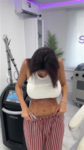 After the tattoo removal procedure, there is only slight swelling and redness in the tattoo area.