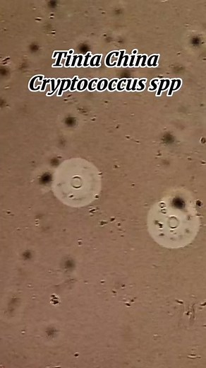 Tinta china Cryptococcus Spp en líquido cefalorraquídeo | Soy Químico