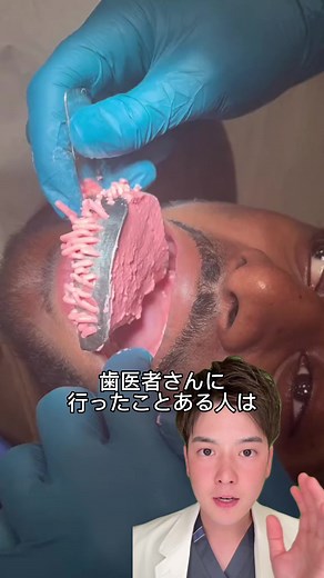 アルジネート印象材詳しく解説 ☟ 歯科での歯の型取り(印象)とは主にアルジネートと呼ばれるピンク色の型取りの材料(印象材)を使って口の中の型を取ることです。 アルジネートで型をとり、その型に石膏を流し模型にすることで患者様の口の中を石膏の模型で再現することができます。 その印象でうつしだされた模型を使い被せ物や入れ歯等を作ることになります。 アルジネート印象材は水溶性のアルギン酸塩と石こうを反応させて、不溶性のアルギン酸カルシウムとして硬化させる印象材です。アルジネート印象材は操作が簡単ですが、乾燥に弱かったりと硬化後の安定性が少なく、強度的にも充分でないのが難点です。#歯科医師 #おすすめ