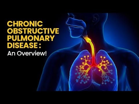 Management of COPD | Medical Surgical Nursing Lecture | Treatment & Nursing Care---
