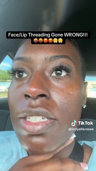 Lip Threading Gone Wrong: My Terrifying Experience