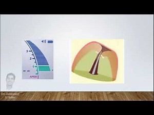 Apex locators - Correct method to measure working length !!