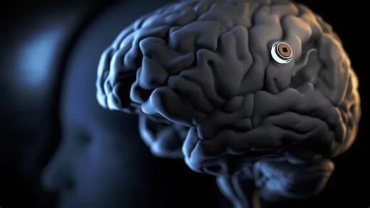 They're testing it on people - what Neuralink is actually doing