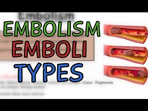 EMBOLISM EXPLAINED IN 2 MINUTES | WHAT IS AN EMBOLISM? EMBOLUS | TYPES OF EMBOLI - 5MINUTESCHOOL