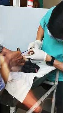 Great Dane ear crop procedure