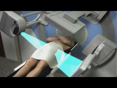 Medical Device | MOA Animation