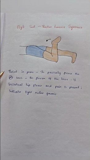 Elys Test -Rectus Femoris Tightness