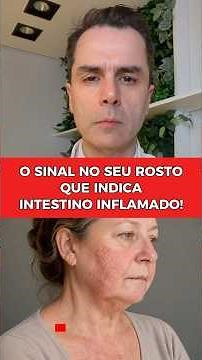 O sinal no seu ROSTO que indica intestino inflamado!
