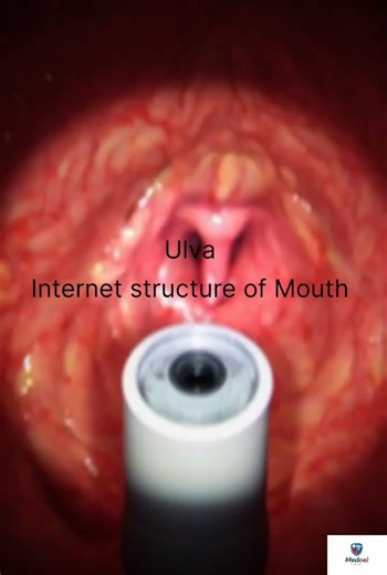 Endoscopy Test Full Guide | Painful Hai Ya Nahi?