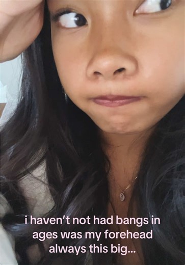 Understanding Forehead Dysmorphia and Its Effects