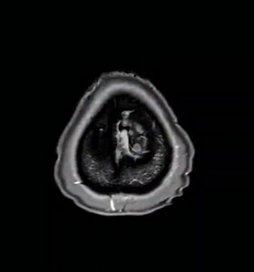 164K views · 879 reactions | What's the prognosis? | Neurology | Facebook