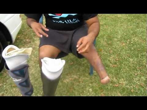 Double Amputee Dwayne - Stumps walking on concrete