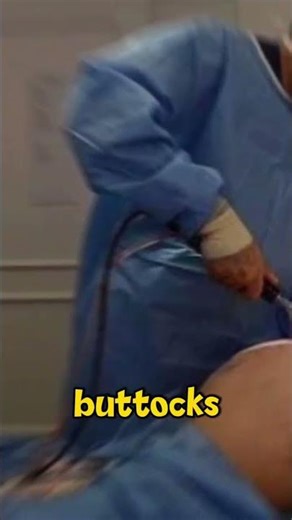 WHY BBL IS THE DEADLIEST COSMETIC SURGERY #bbl #cosmeticsurgery #documetary #shorts #youtubeshorts