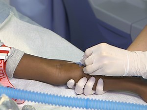 Continuous Manual Exchange Transfusion for Patients with Sickle Cell Disease: An Efficient Method to Avoid Iron Overload