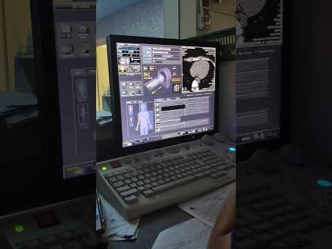 CT Aortogram with Intravenous Contrast on Canon 16-Slice CT Scanner