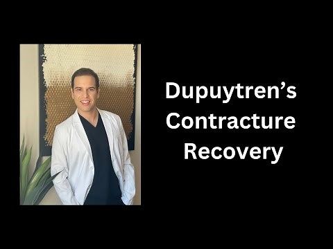 Dupuytren's Contracture Surgery Recovery