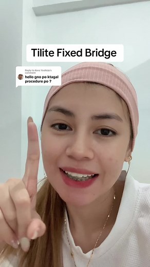 How much do fixed bridge teeth cost? Procedure, longevity, and more