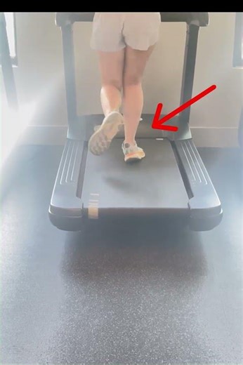 Poor Running form Causes ACL & Mensicus Tears
