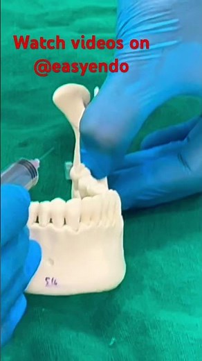 Inferior Alveolar Nerve Block #dentist #dentistry #dental #mandible