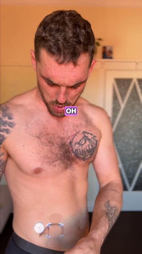 8.1K views | First time putting my Libre Sensor Plus 2 in my stomach I swear I don’t have enough fat there, but my arm’s too far from the pump so… here we go Feels weird, kinda vulnerable, but gotta make it work. #insulinpump #LibreSensor #Type1Diabetes #T1Dlife #lean #fitness | The Sweet Struggle | Facebook