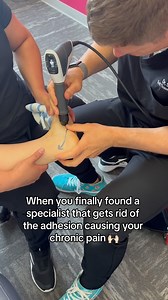 1.3K views · 79 reactions | Yes! Adhesion can causing your chronic...