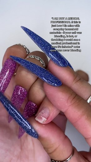 Fixing a Broken Nail: Easy At-Home Remedies