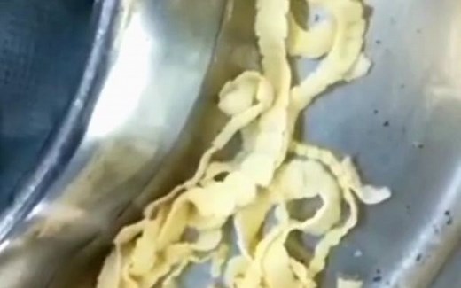 给大家看看术后取出的猪肉绦虫