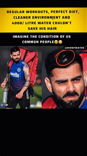 Even Perfect Fitness Can’t Save Hairlines 😭💇‍♂️