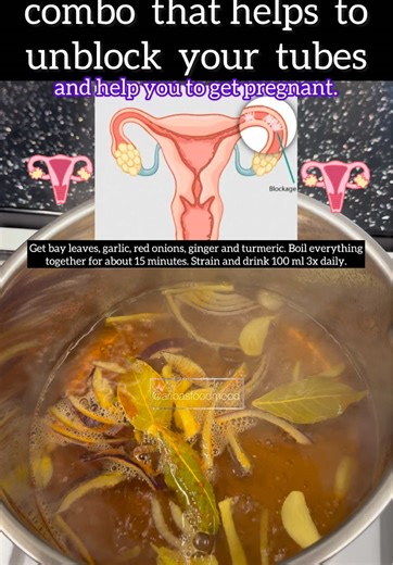 Natural Remedies to Unblock Fallopian Tubes for Pregnancy