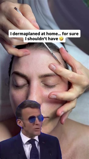 ✨ Why our Dermaplane Facial is so popular (when done professionally)? • Removes dead skin peach fuzz for instant glow • Allows skincare to penetrate deeper • Creates flawless makeup application • Leaves skin smoother, brighter, and more refined • Safe, controlled exfoliation only in trained hands At the clinic, dermaplaning is done with medical-grade blades, proper technique, and customized skin prep — not bathroom lighting and a rushed mirror moment. For sure your skin deserves better. Book it 