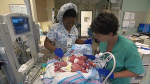 Twins Abigail and Micaela are ready to head home just in time for their first birthday! After an incredibly long journey at UC Davis Children's Hospital the once-conjoined twins are healthy and excited to be reunited with the rest of the family. “This is the best present of my life, it’s very exciting, it’s a huge blessing” – Liliya Miroshnik, mom of the twins. | UC Davis Health