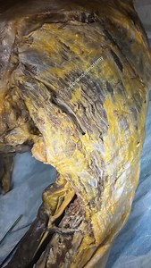 11K views · 309 reactions | Here we are at the posterior aspect of...