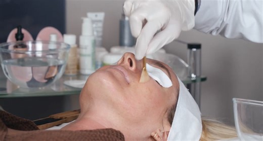 Face Peels: A Radiant Alternative to Botox