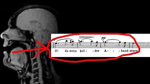 Here’s what happens to your mouth when you sing a beautiful operatic aria inside an MRI scanner