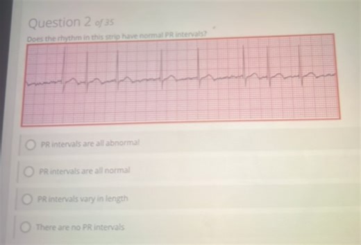 Does the rhythm in this strip have normal PR intervals?  A. PR ... | Filo