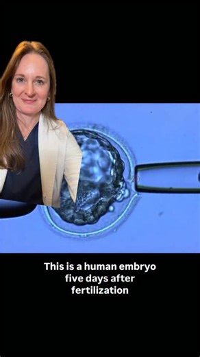 Lora Shahine, MD | Fertility on Instagram: "Embryo biopsy - How do they do that?! If you’re watching this, you’re seeing a blastocyst under the microscope as a tiny group of cells is gently removed for testing. And the biggest question I hear is: Does this harm the embryo? Here’s what I tell my patients: A blastocyst has two parts— • Inner cell mass: the cluster of cells that becomes the fetus • Trophectoderm: the outer layer that becomes the placenta During a biopsy, we remove just a few trophe