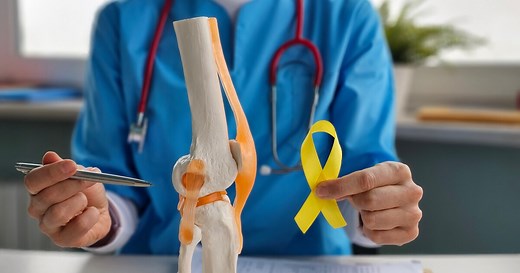 Cáncer de huesos: causas, síntomas y tratamiento